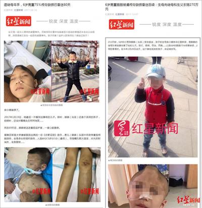 渭南虐童案新进展：生父被逮捕，涉虐待罪遗弃罪将被起诉