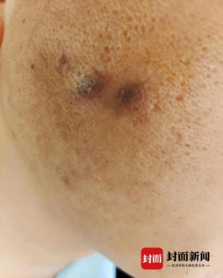 业绩太差就被高管用烟头烫脸？警方已介入调查